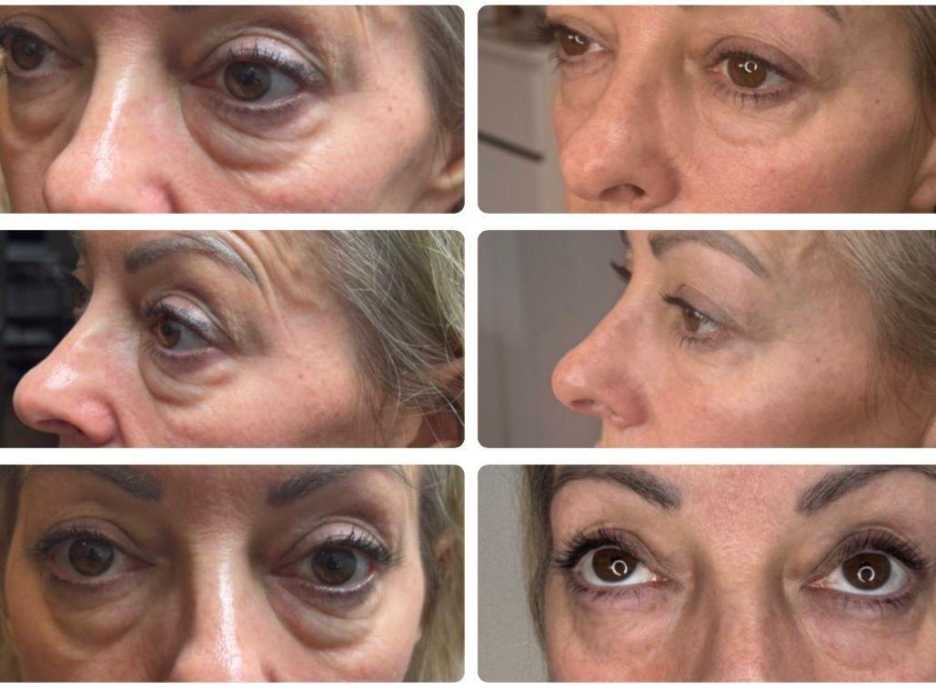 PHOTO-2026-02-05-13-08-00